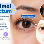 Lacrimal Punctum Struktur Kecil Dengan Fungsi Vital Sistem Mata